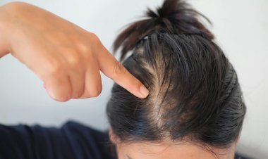 Natural Ways to Regrow Thinning Hair